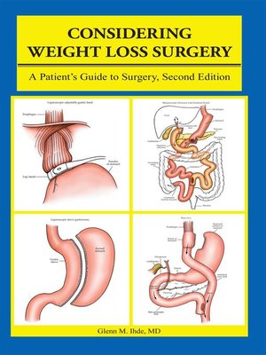 cover image of Considering Weight Loss Surgery